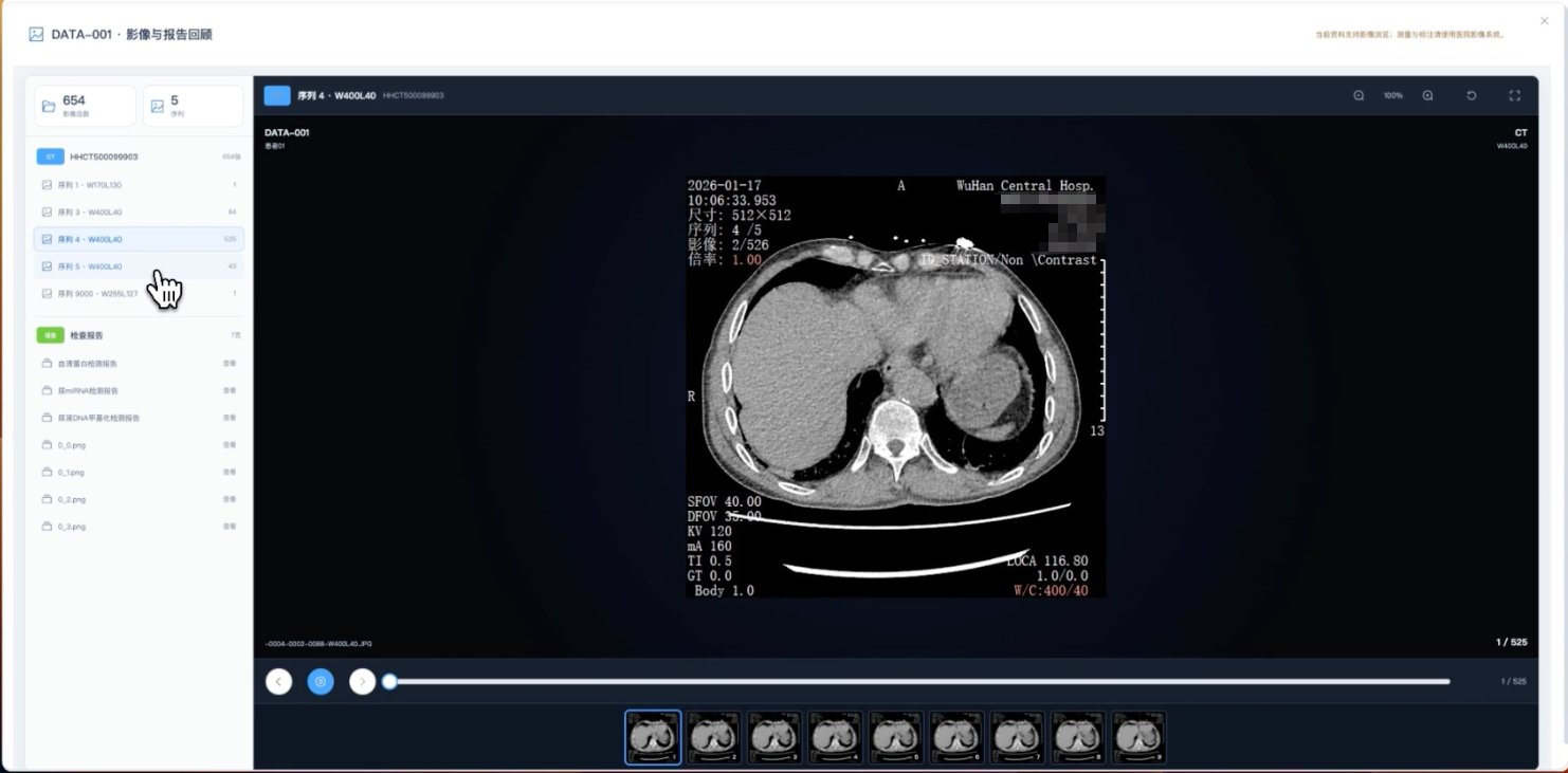 泌尿智析/Urofusion AI 截图